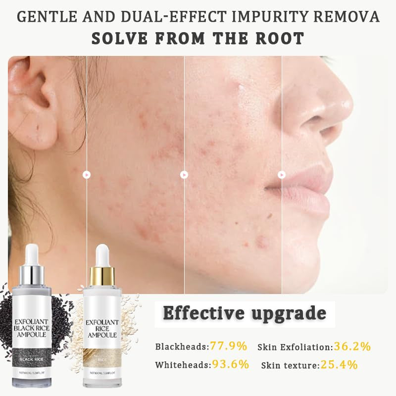 2PCS Rice Exfoliating Ampoule Set – Black & White Rice Brightening Duo for Glowing Skin | Gentle Peel + Pore Minimizing & Deep Hydration
