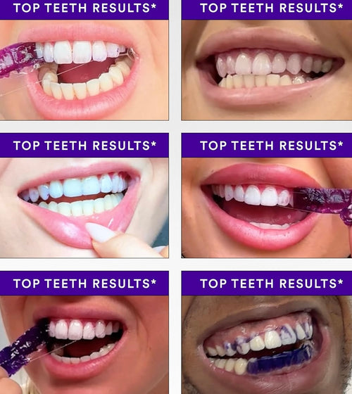 42Strips Purple Whitening Tooth Patch Fresh Breath Tooth Brightening Stickers Remove Yellow Stains for Smokers & Coffee Drinkers