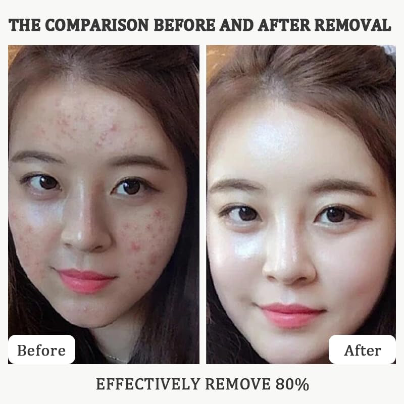 2PCS Rice Exfoliating Ampoule Set – Black & White Rice Brightening Duo for Glowing Skin | Gentle Peel + Pore Minimizing & Deep Hydration